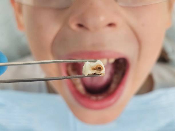 Urgent Tooth Repair in AZ